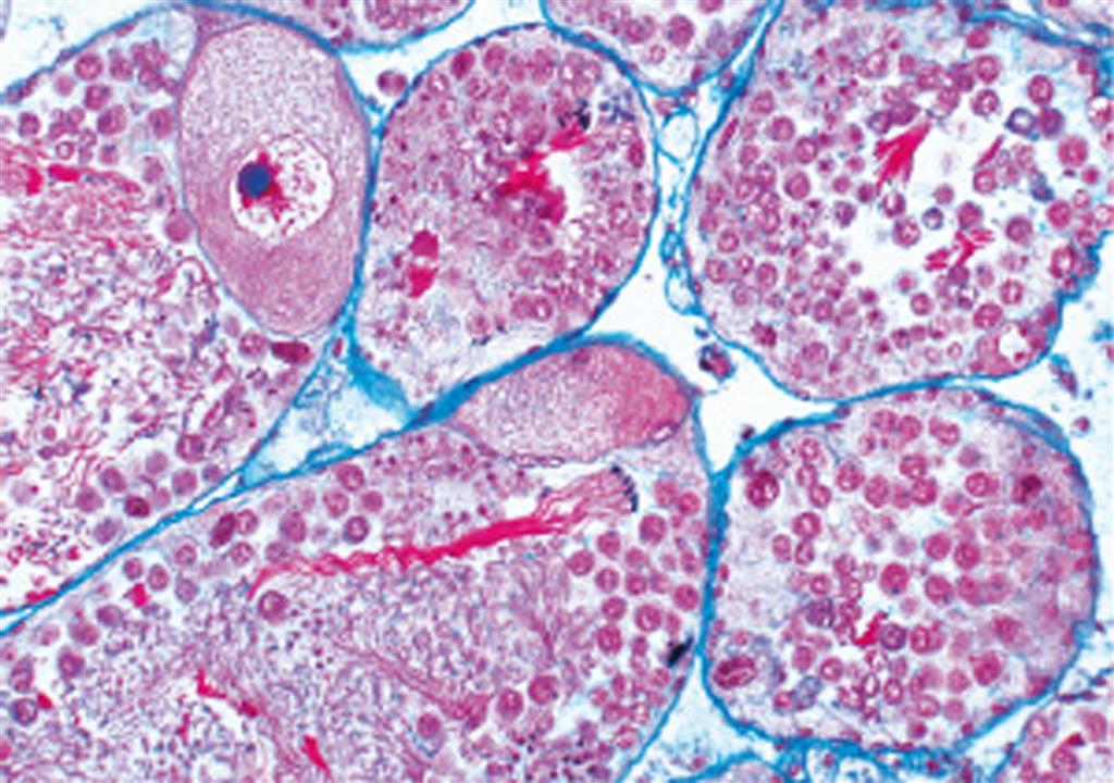 Parasitologie Gro E Serie Mikropr Parate Der Hedinger De